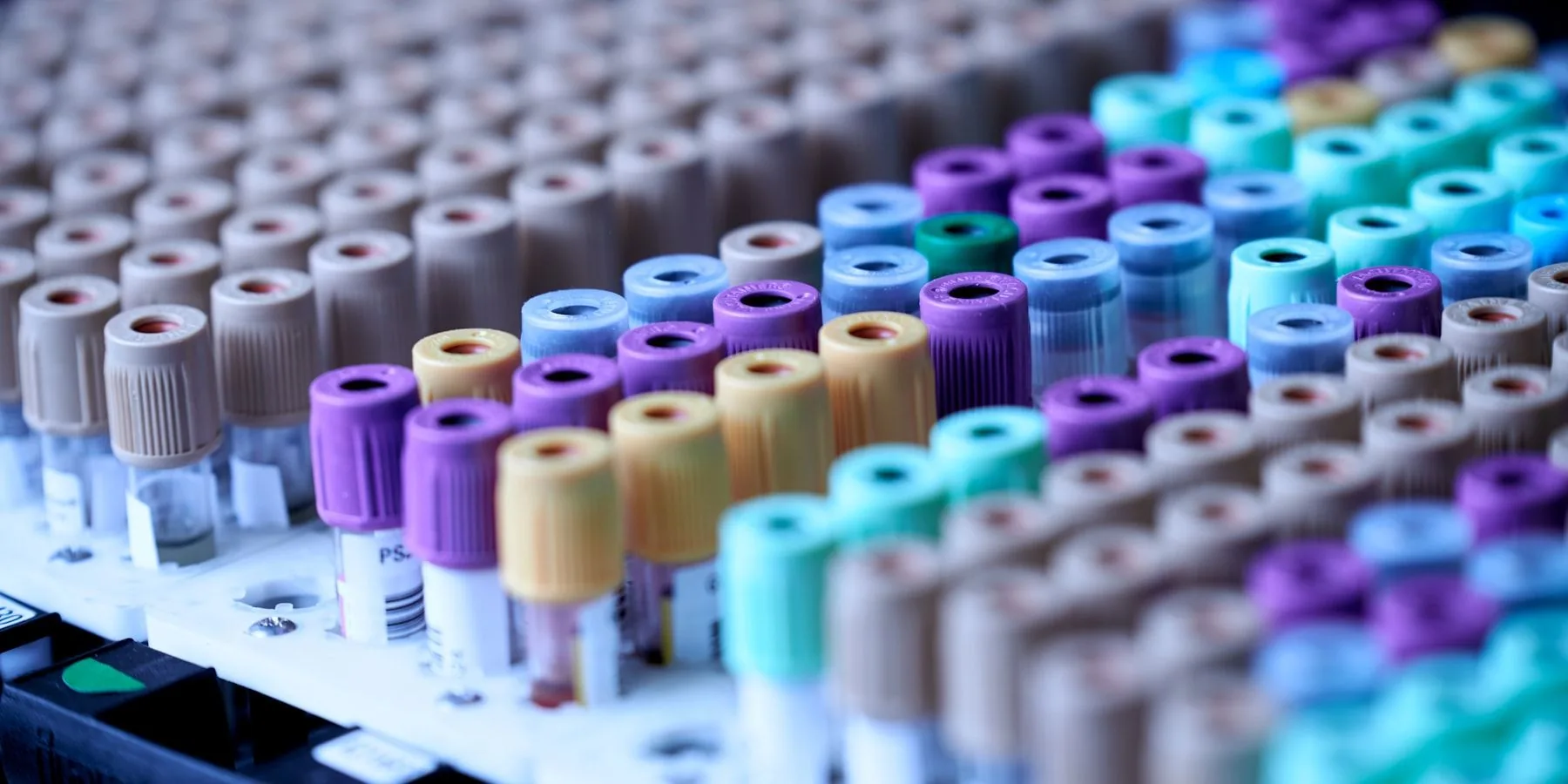 Rangées de tubes de prélèvement à bouchons colorés dans un laboratoire